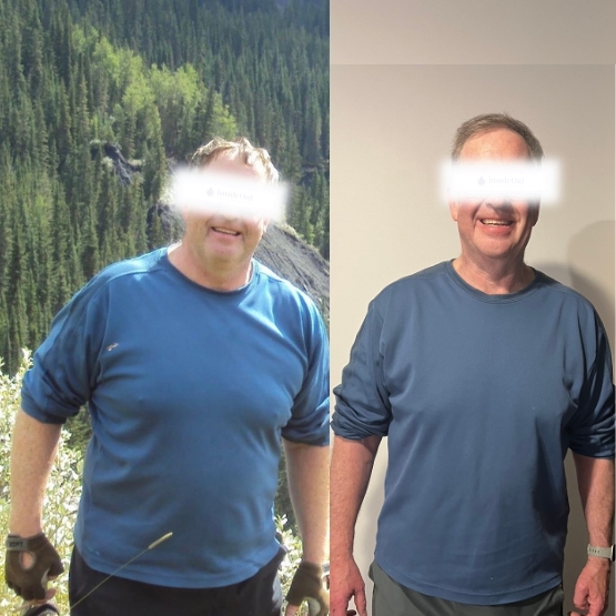 Image of Don, Before and After
